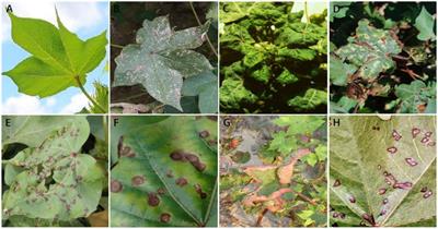 Compressing recognition network of cotton disease with spot-adaptive knowledge distillation